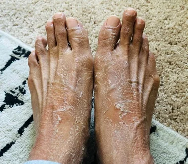 Foot Peel Mask Avis