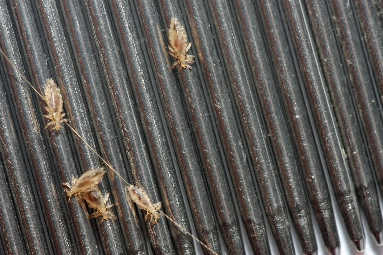 Close-up of several live head lice on a dark hair comb with strands of hair caught in the teeth.